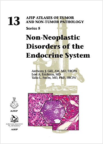 Atlases of Tumor & Non-Tumor Pathology, 5th Series,Fascicle 13- Non-Neoplastic Disorders of Endocrine System