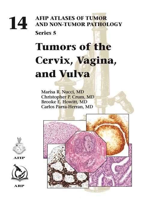 Atlases of Tumor & Non-Tumor Pathology, 5th Series,Fascicle 14- Tumors of Cervix, Vagina, & Vulva