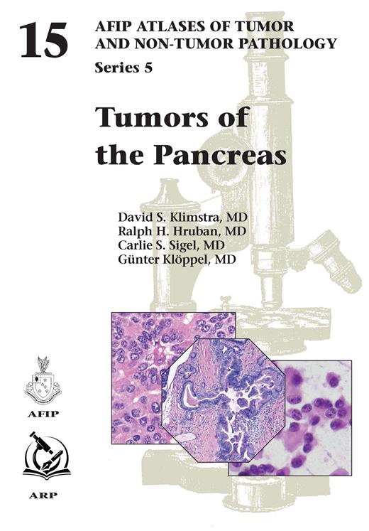 Atlases of Tumor & Non-Tumor Pathology, 5th Series,Fascicle 15- Tumors of Pancreas