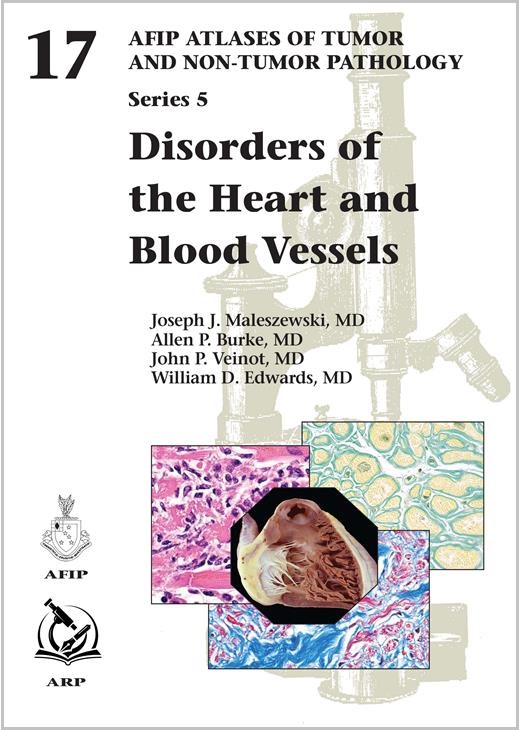 Atlases of Tumor & Non-Tumor Pathology, 5th Series,Fascicle 17- Disorders of Heart & Blood Vessels