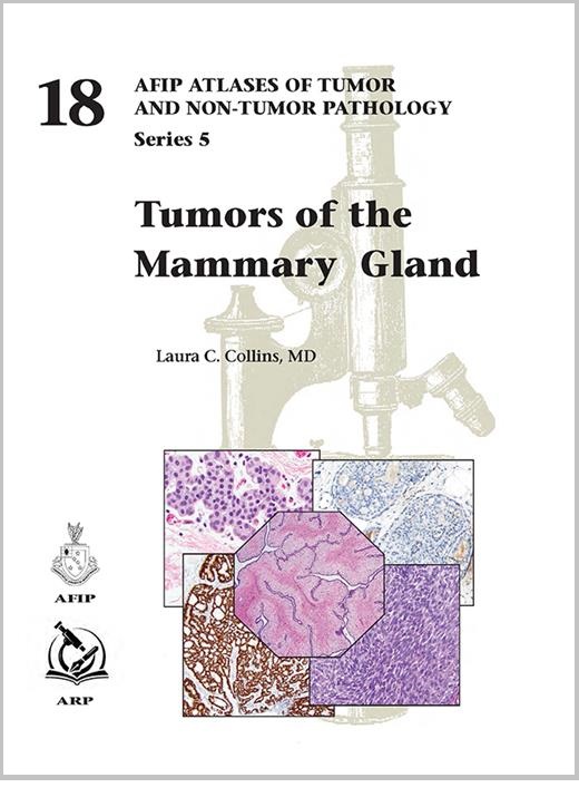 Atlases of Tumor & Non-Tumor Pathology, 5th Series,Fascicle 18- Tumors of Mammary Gland