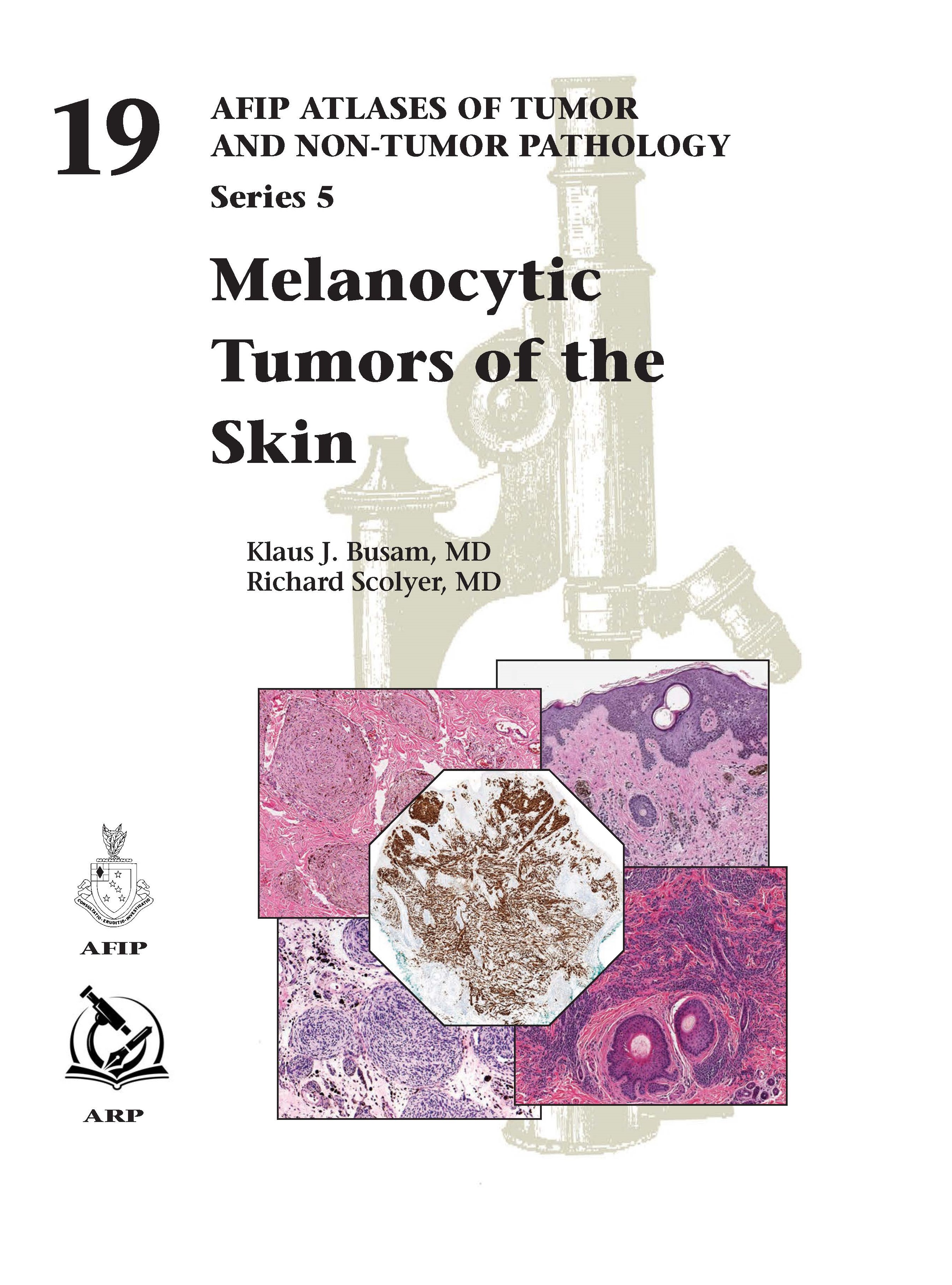 Atlases of Tumor & Non-Tumor Pathology, 5th Series,Fascicle 19- Melanocytic Tumors of Skin