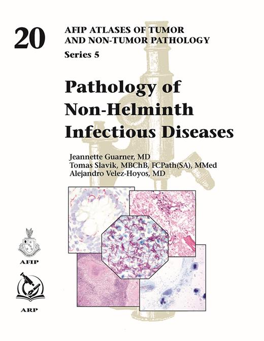 Atlases of Tumor & Non-Tumor Pathology, 5th Series,Fascicle 20- Pathology of Non-Helminth Infectious Diseases