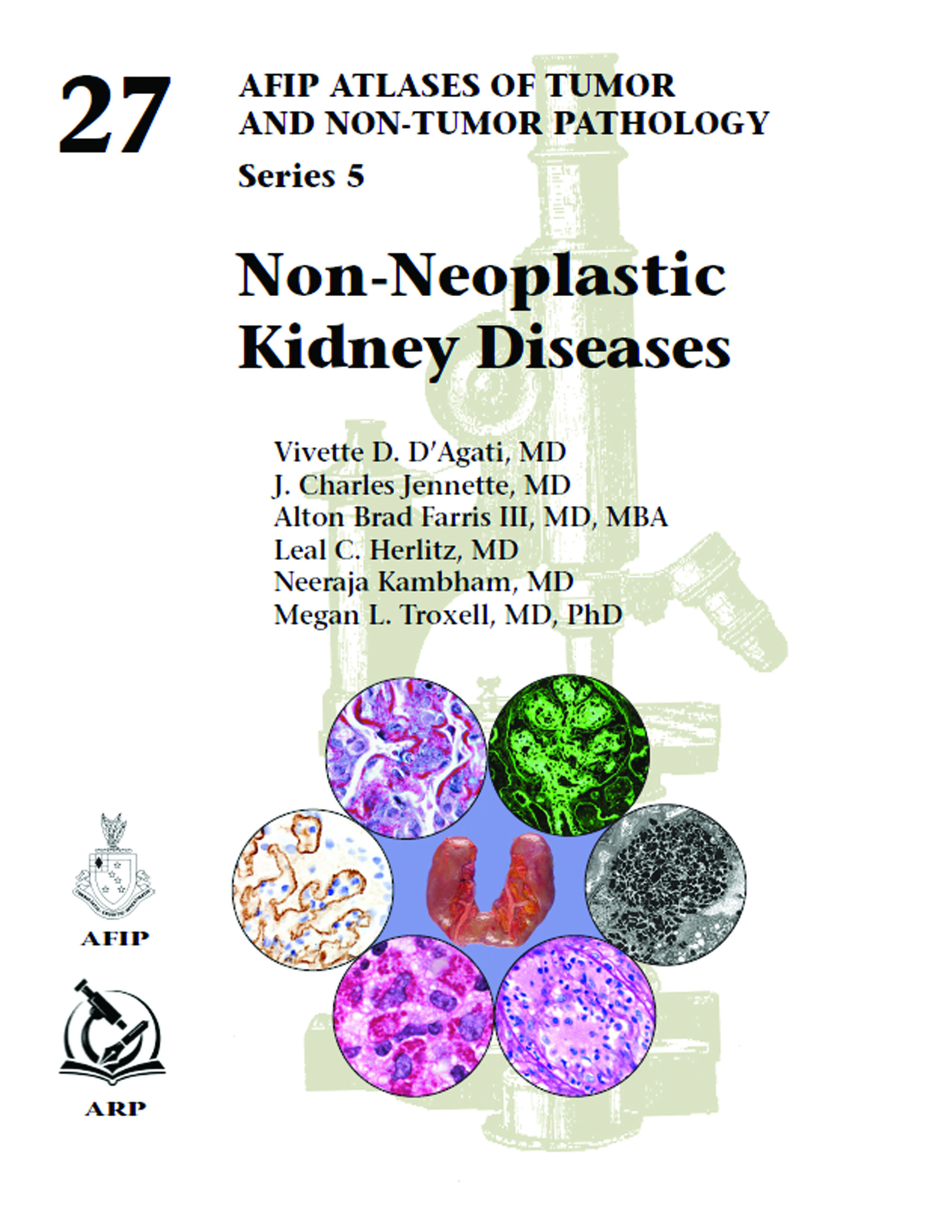 Atlases of Tumor & Non-Tumor Pathology, 5th Series,Fascicle 27- Non-Neoplastic Kidney Diseases
