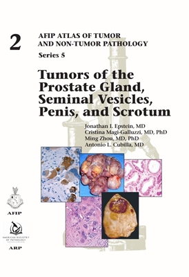 Atlas of Tumor & Non-Tumor Pathology, 5th Series,Fascicle 2- Tumors of Prostate Gland, Seminal Vesicles, Penis,& Scrotum