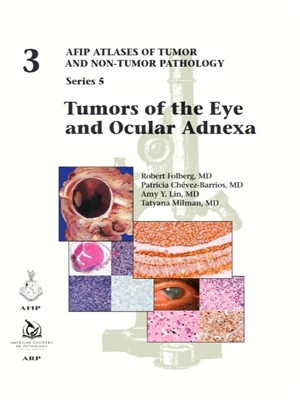 Atlases of Tumor & Non-Tumor Pathology, 5th Series,Fascicle 3- Tumors of Eye & Ocular Adnexa