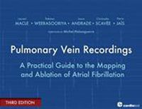 Pulmonary Vein Recordings, 3rd ed.- A Practical Guide to the Mapping & Ablation of AtrialFibrillation