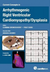 Current Concepts in Arrhythmogenic Right VentricularCardiomyopathy/Dysplasia