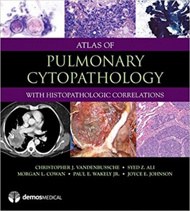 Atlas of Pulmonary CytopathologyWith Histopathologic Correlations