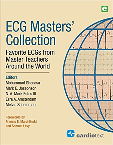 ECG Master's Collection- Favorite ECGs from Master Teachers Around the World