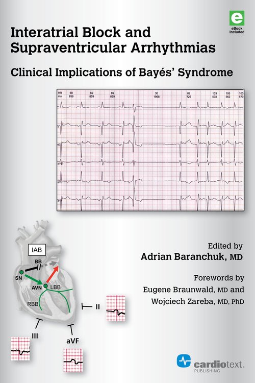 Interatrial Block & Supraventricular Arrhythmias- Clinical Implications of Bayes Syndrome