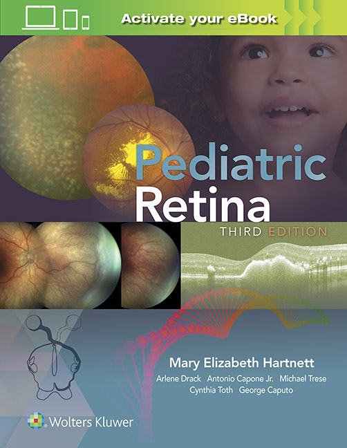 Pediatric Retina, 3rd ed.
