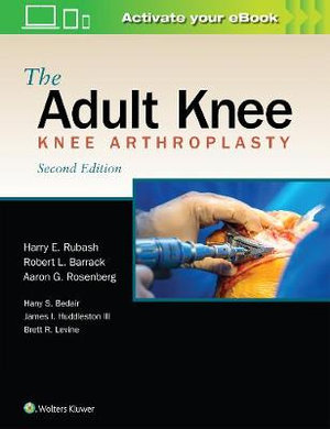 Adult Knee, 2nd ed.- Knee Arthroplasty