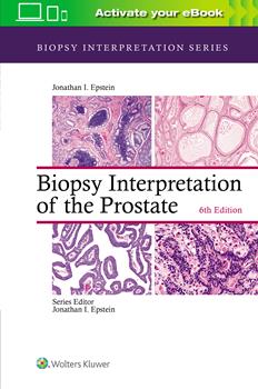 Biopsy Interpretation of the Prostate, 6th ed.(Biopsy Interpretation Series)