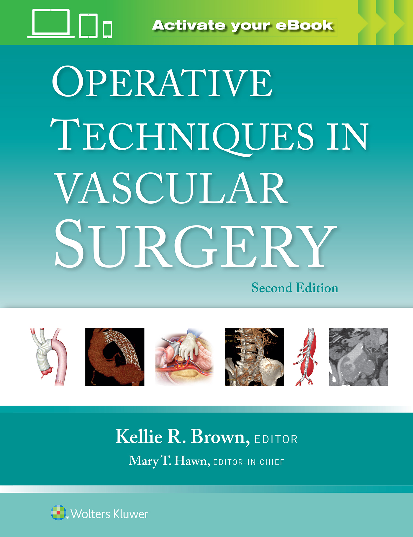 Operative Techniques in Vascular Surgery, 2nd ed.