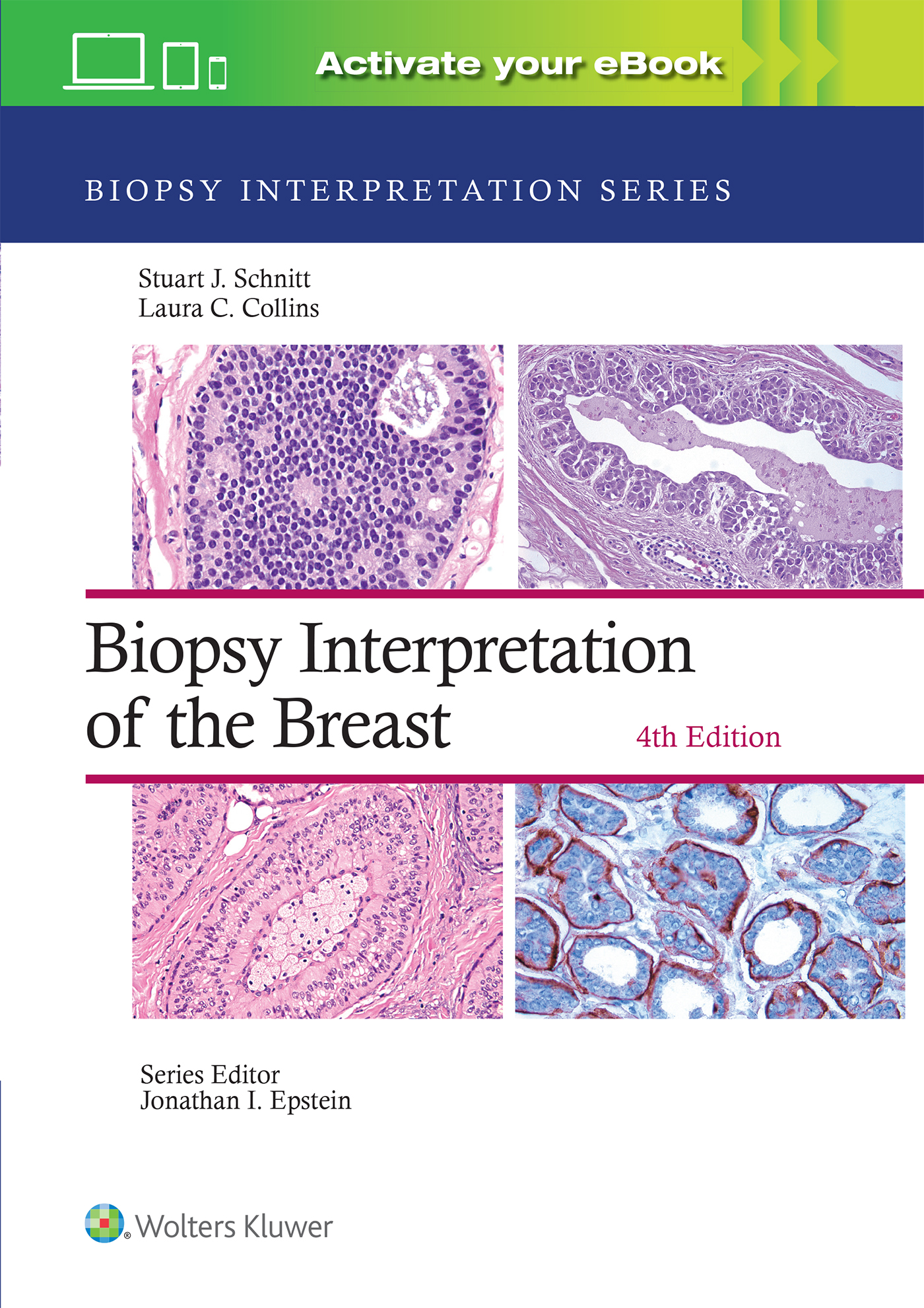 Biopsy Interpretation of the Breast, 4th ed.