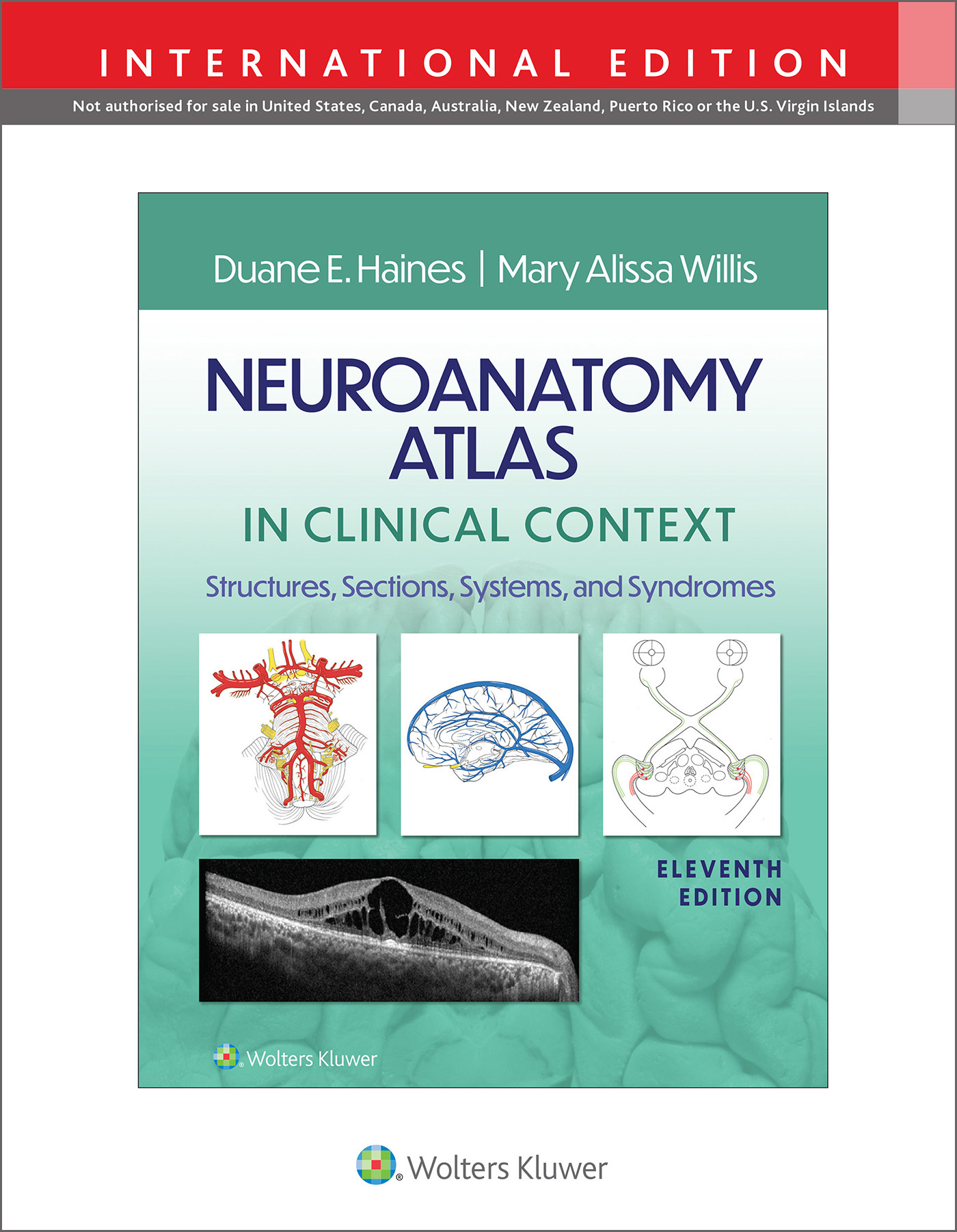 Neuroanatomy Atlas in Clinical Context, 11th ed.(Int'l ed.)- Structures, Sections, Systems & Syndromes