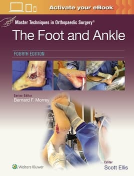 Foot & Ankle, 4th ed.(Master Techniques in Orthopaedic Surgery)