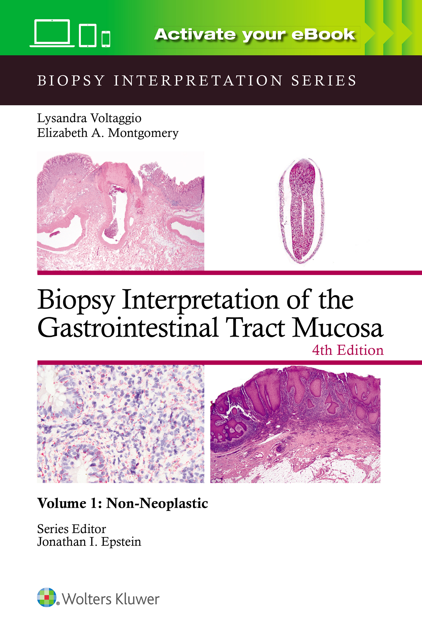 Biopsy Interpretation of the Gastrointestinal TractMucosa, 4th ed.Vol.1: Non-Neoplastic