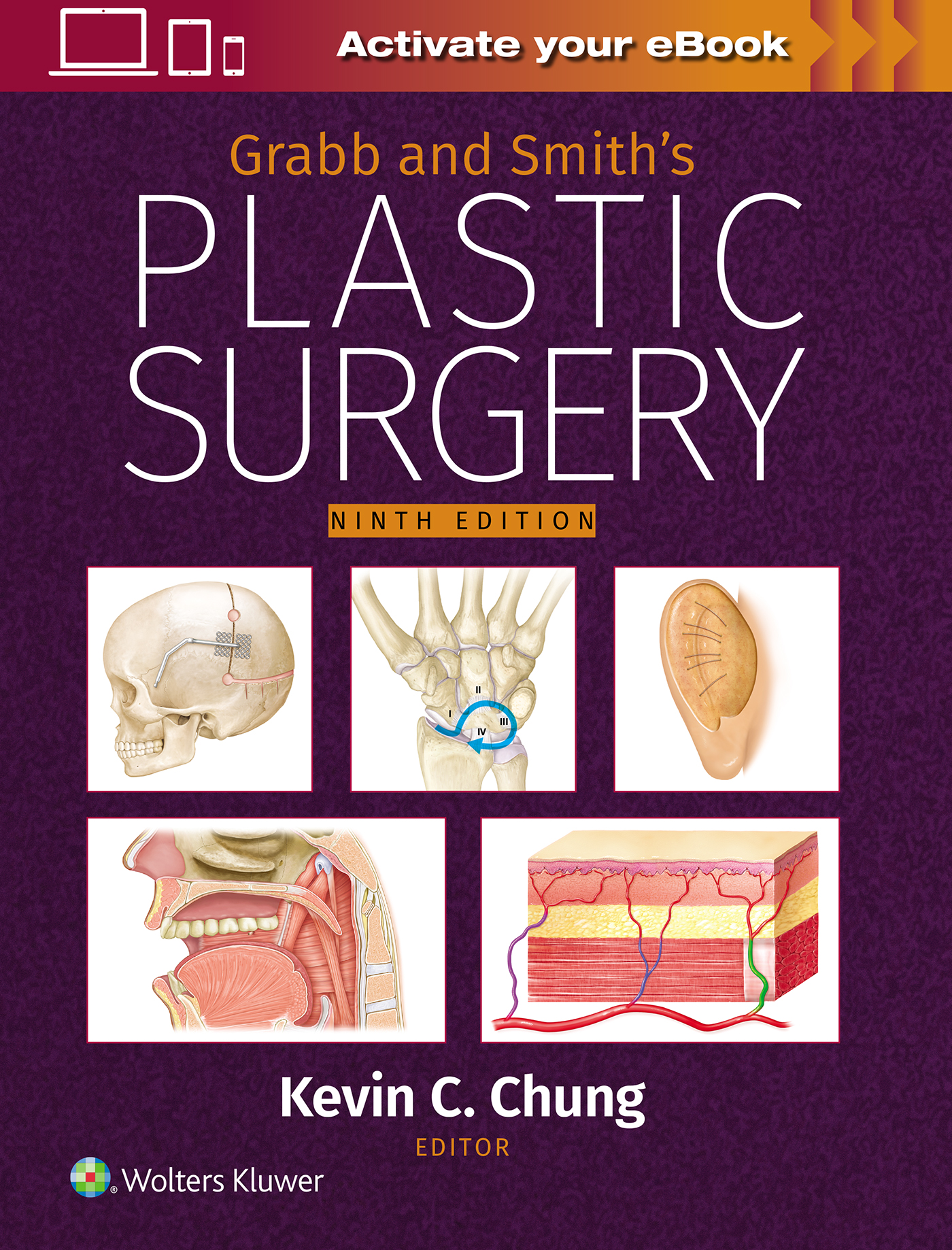 Grabb & Smith's Plastic Surgery, 9th ed.