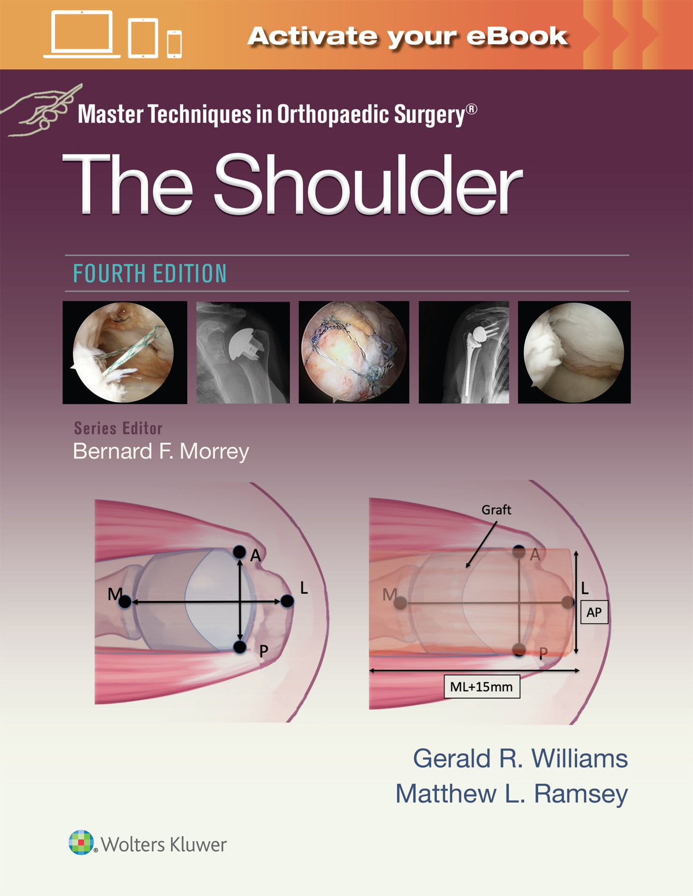 Shoulder, 4th ed.(Master Techniques in Orthopaedic Surgery Series)