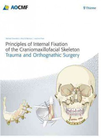 Principles of Internal Fixation of theCraniomaxillofacial Skeleton- Trauma & Orthognathic Surgery