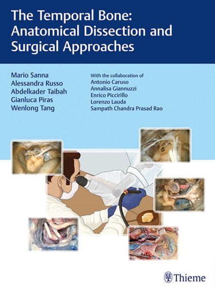Temporal Bone- Anatomical Dissection & Surgical Approaches