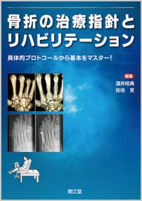 骨折の治療指針とリハビリテーション: 書籍／南江堂