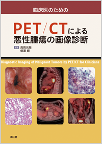 臨床医のためのPET/CTによる悪性腫瘍の画像診断: 書籍／南江堂
