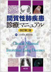 間質性肺疾患診療マニュアル改訂第2版
