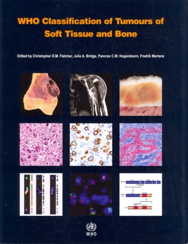 WHO Classification of Tumours of Soft Tissue & Bone,4th ed.(WHO Classification of Tumours, Vol.5)