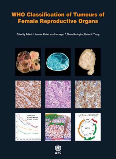 WHO Classification of Tumours of Female ReproductiveOrgans, 4th ed.(WHO Classification of Tumours, Vol.6)