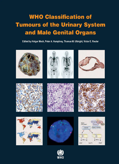 WHO Classification of Tumours of Urinary System & MaleGenital Organs, 4th ed.(WHO Classification of Tumours, Vol.8)