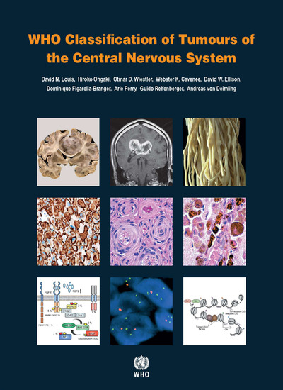 WHO Classification of Tumours of the Central NervousSystem, 4th ed. Revised ed.(WHO Classification of Tumours, Vol.1)