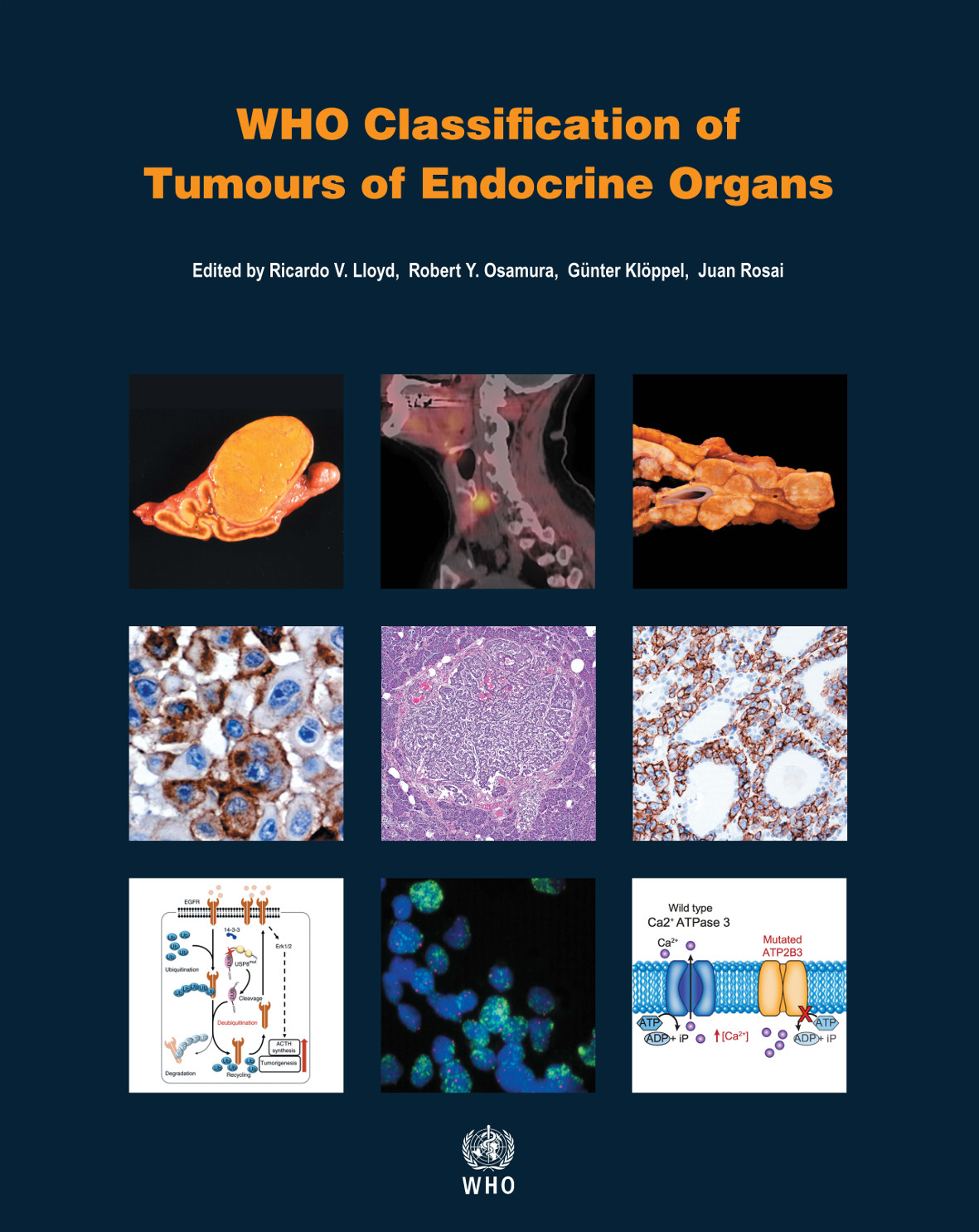 WHO Classification of Tumours of Endocrine Organs,4th ed.(WHO Classification of Tumours, Vol.10)