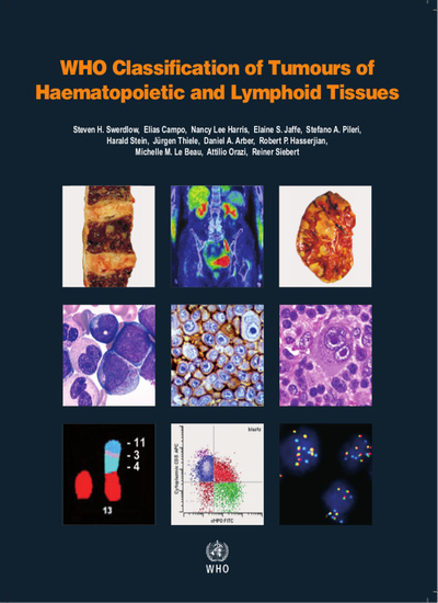 WHO Classification of Tumours of Haematopoietic &Lymphoid Tissues, 4th ed., Revised ed.
