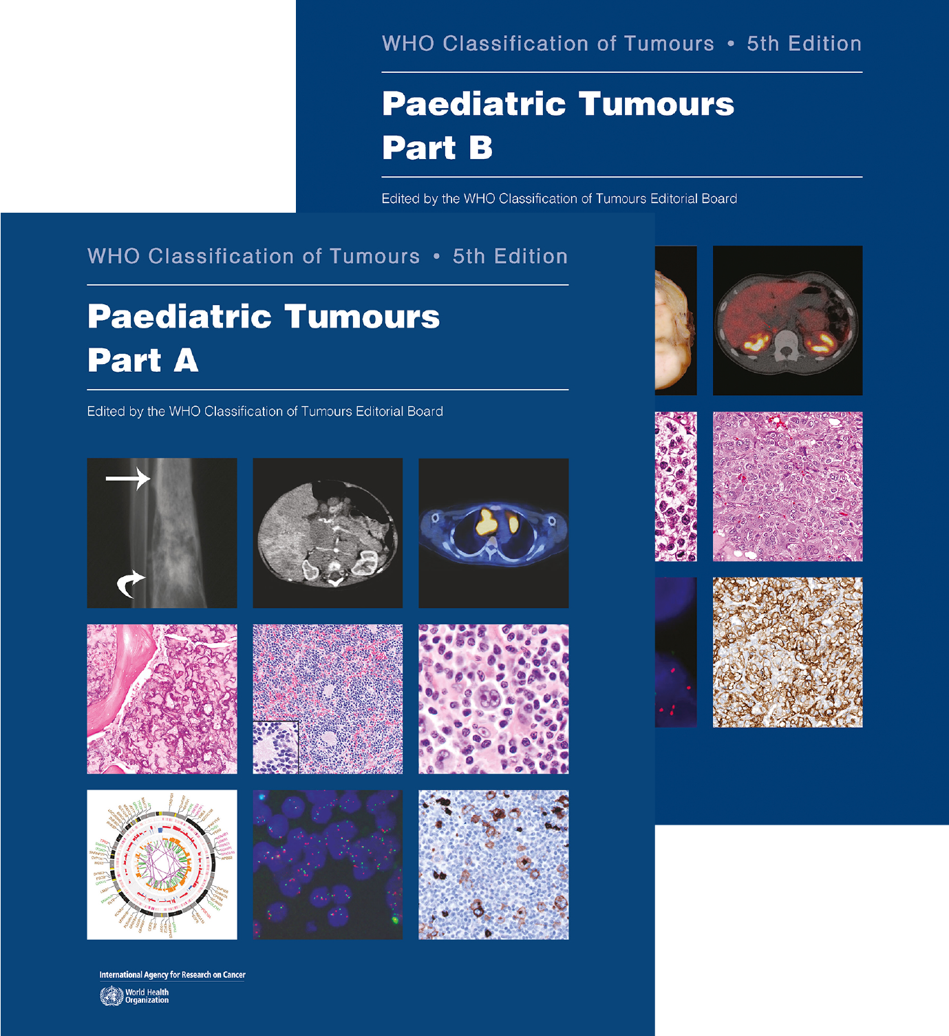 WHO Classification of Tumours, 5th ed., Vol.7In 2 vols.Paediatric Tumours