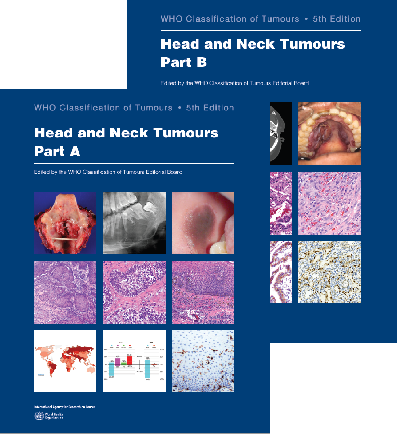 WHO Classification of Tumours, 5th ed., Vol.9In 2 vols.Head & Neck Tumours