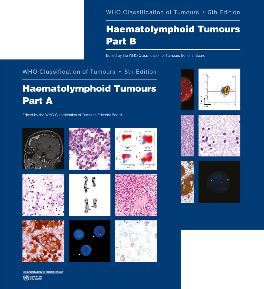 WHO Classification of Tumours, 5th ed., Vol.11In 2 vols.Haematolymphoid Tumours