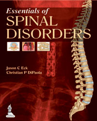 Essentials of Spinal Disorders