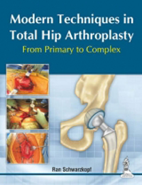 Modern Techniques in Total Hip Arthroplasty- From Primary to Complex