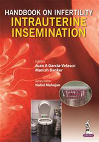 Intrauterine Insemination(Infertillity Management Series)