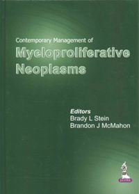 Contemporary Management of Myeloproliferative Neoplasms