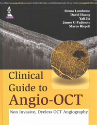 Clinical Guide to Angio-OCT- Non Invasive, Dyeless OCT Angiography