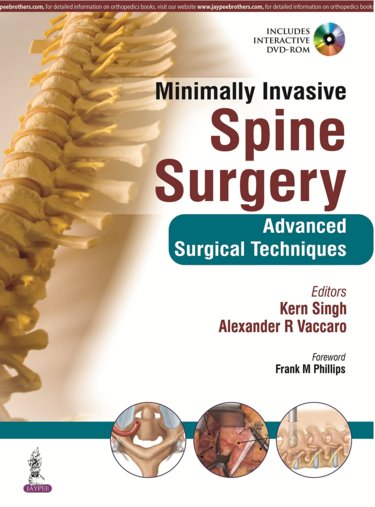 Minimally Invasive Spine Surgery- Advanced Surgical Techniques