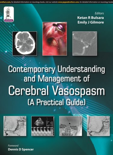 Contemporary Understanding & Management of CerebralVasospasm(Practical Guide)