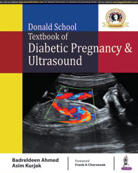 Donald School Textbook of Diabetic Pregnancy &Ultrasound