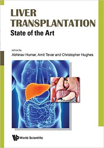 Liver Transplantation- State of the Art