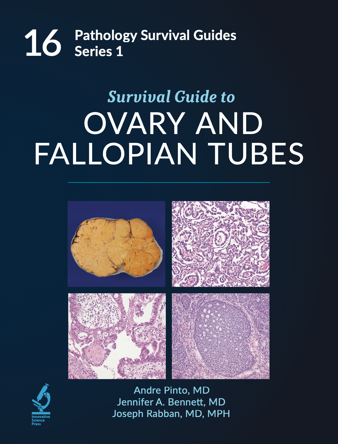 Pathology Survival Guides, Series 1Vol.16: Survival Guide to Ovary & Fallopian Tubes