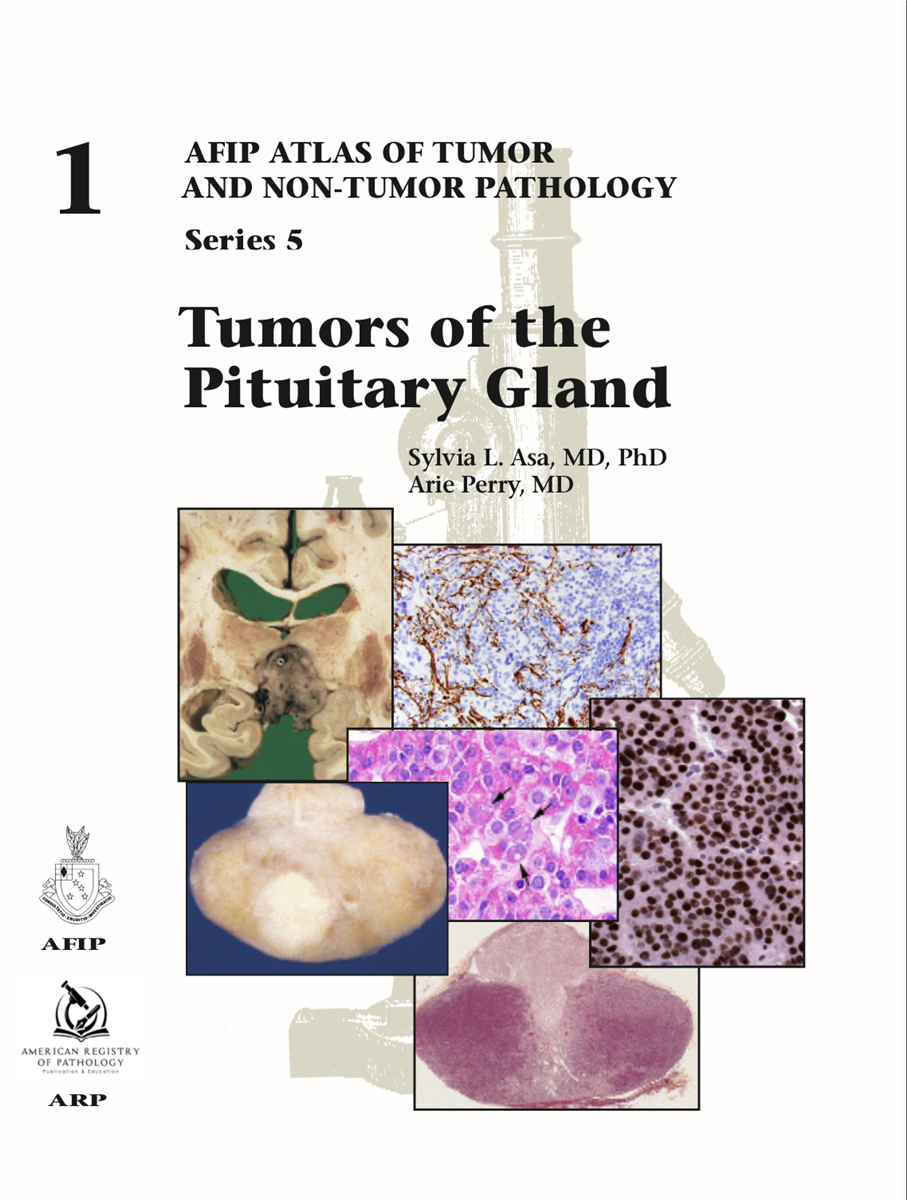 Atlas of Tumor & Non-Tumor Pathology, 5th Series,Fascicle 1- Tumors of the Pituitary Gland